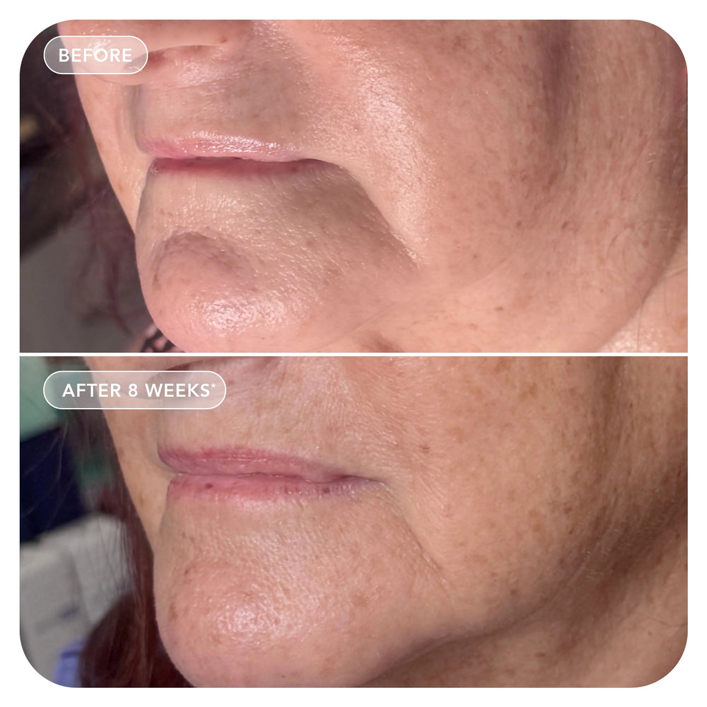 Esteryn™ Volume Recall Serum