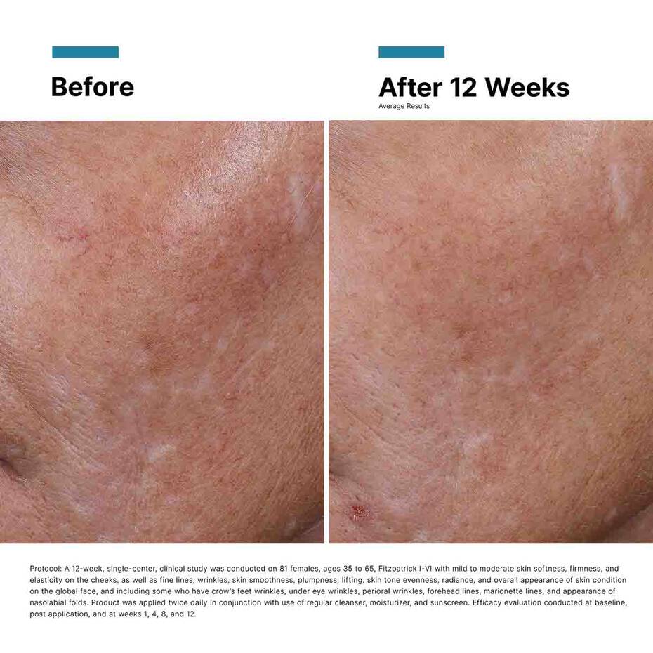 Esteryn™ Volume Recall Serum