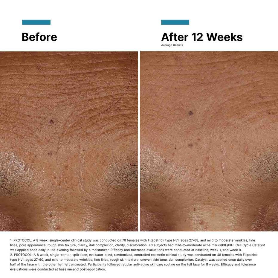 Esteryn™ Volume Recall Serum