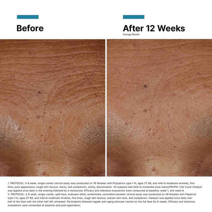 Esteryn™ Volume Recall Serum