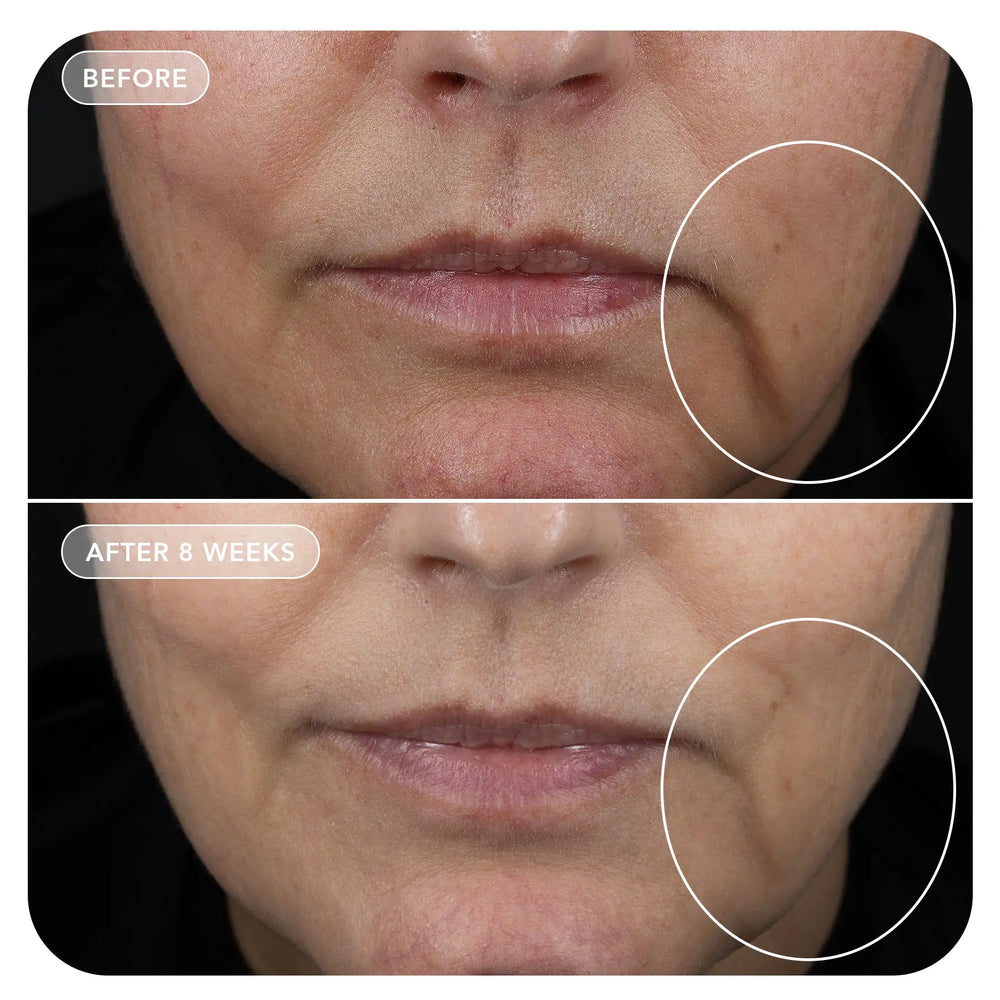 Esteryn™ Volume Recall Serum
