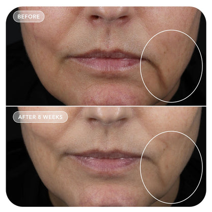 Esteryn™ Volume Recall Serum