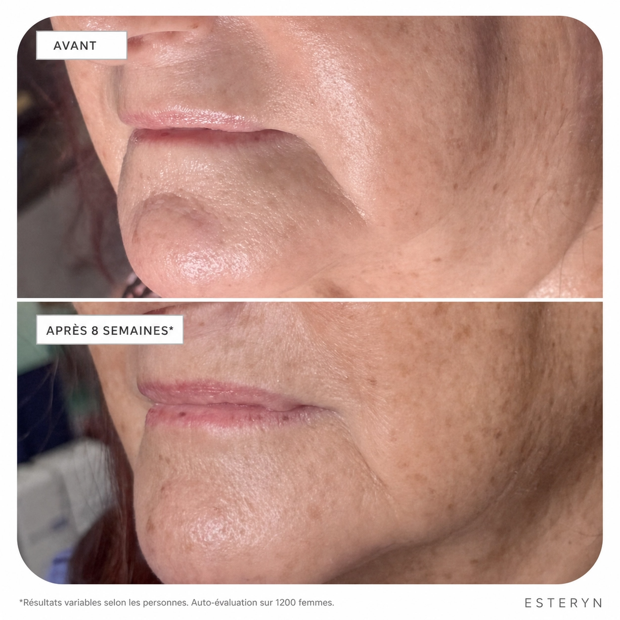 Esteryn™ Volume Recall Serum