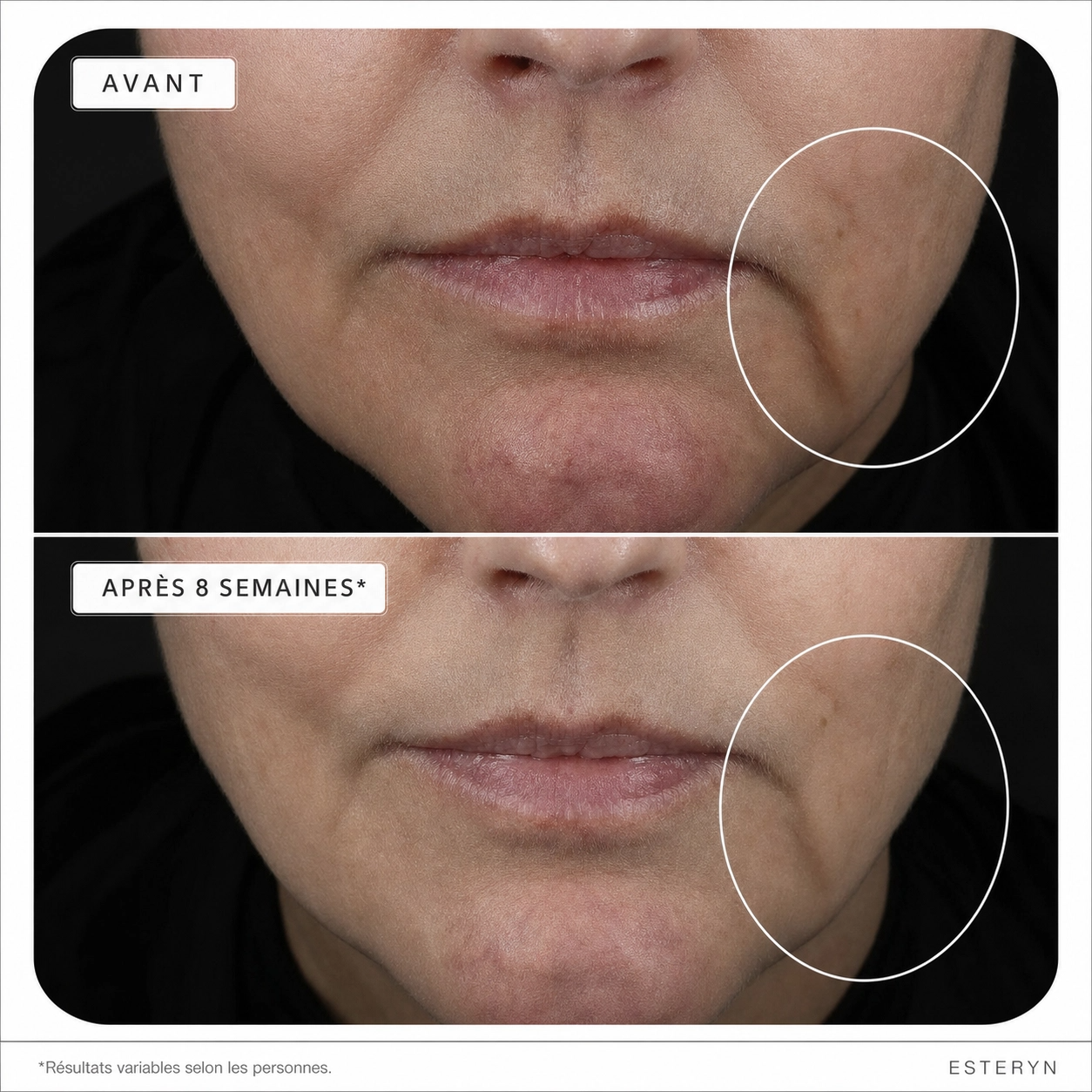 Esteryn™ Volume Recall Serum