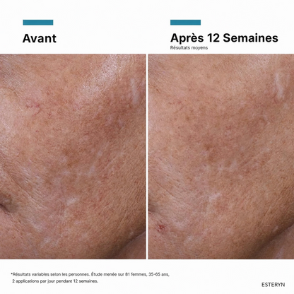 Esteryn™ Volume Recall Serum